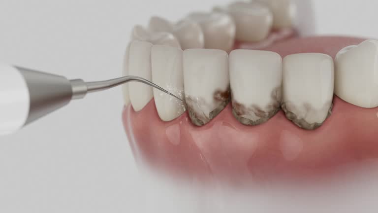Reliable Dental Implants contractor in Hammond, LA by Smile Center Dentistry